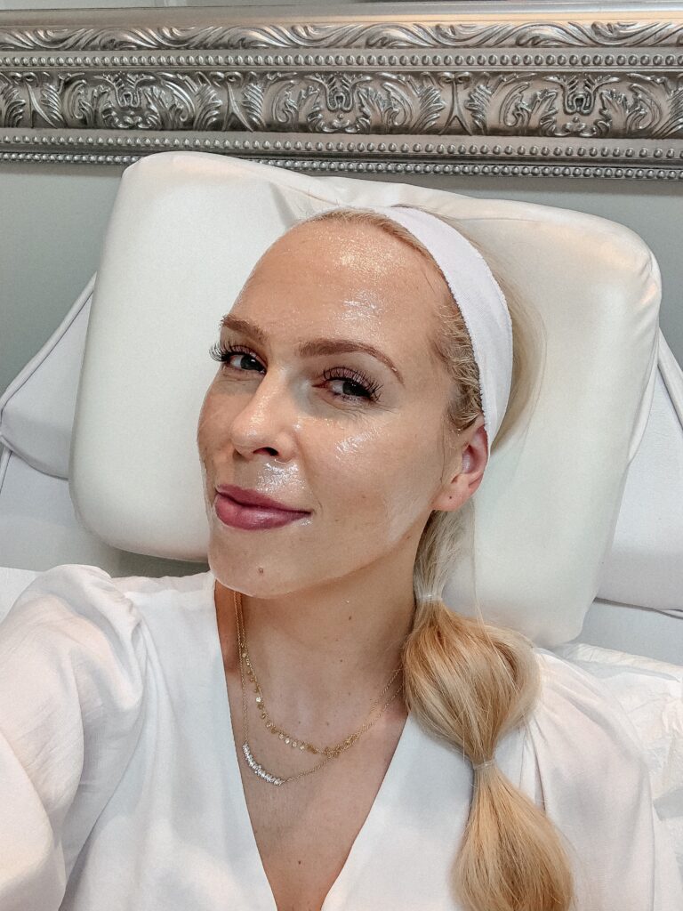 Microneedling 101 featured by top San Francisco fashion blogger Lombard and Fifth.