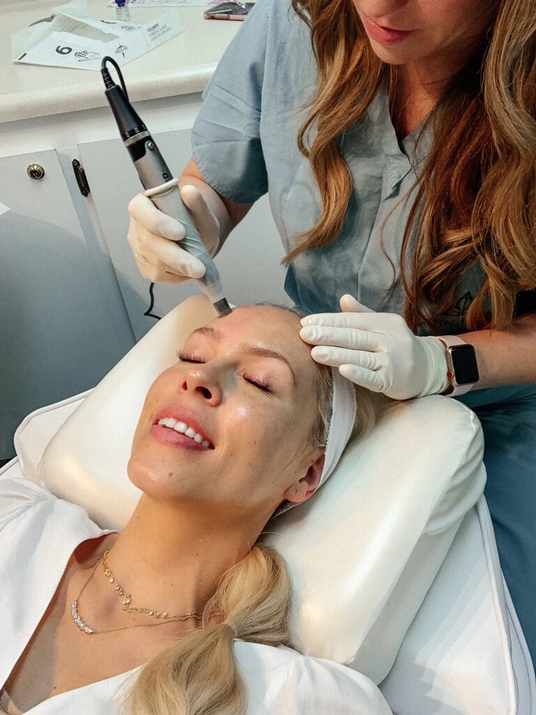 Microneedling with Botox featured by top San Francisco fashion blogger Lombard and Fifth.